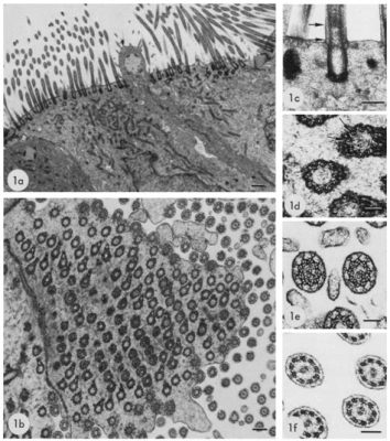  Heterotrichia: Eine unglaubliche Reise durch die Welt der beweglichen Cilien!