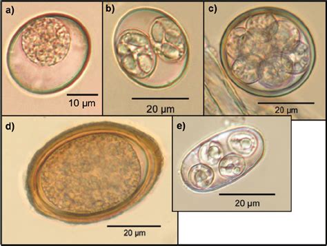  Isospora! Ein winziges Wesen mit gigantischem Einfluss auf die Tierwelt