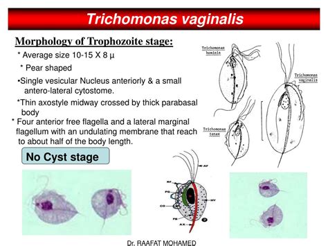  Trichomonas! Ein Flagellat mit unerwartetem Lebensraum